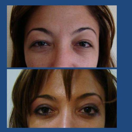 Before after photos of our patients 0